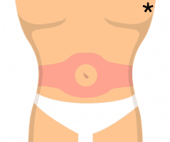 How to use melanotan 2 - injection area