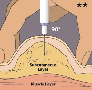 melanotan 2 tanning injection how to insert the needle